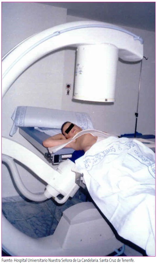 Figura 7. Paciente diagnosticado de oxalosis prepararado para recibir una sesion de litotricia extracorpórea