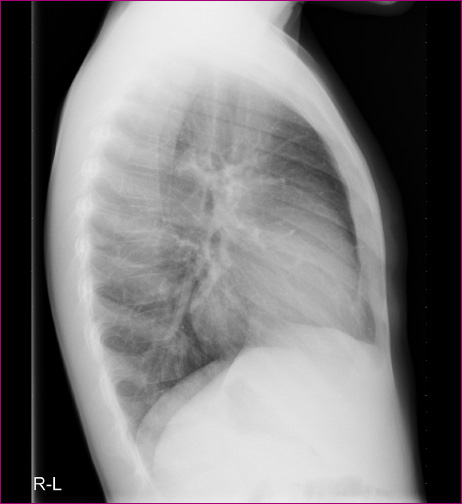 Figura 2. Radiografía lateral.