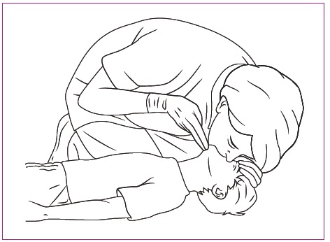 Figura 4. Maniobra frente-mentón en el niño con hipextensión del cuello y técnica de insuflación