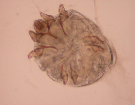 Figura 2. Sarcoptes scabiei. Aspecto del parásito adulto en la visión directa al microscopio óptico tras el frotis de un surco acarino