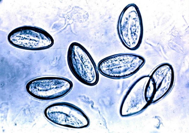 Figura 2. Visualización directa de huevos de Enterobious vermicularis al microscopio óptico