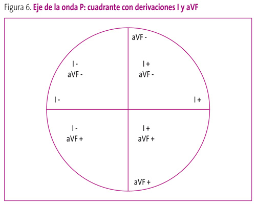 Figura 6. Eje de la onda P: cuadrante con derivaciones I y aVF