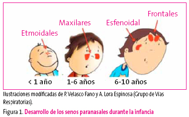 Figura 1. Desarrollo de los senos paranasales durante la infancia